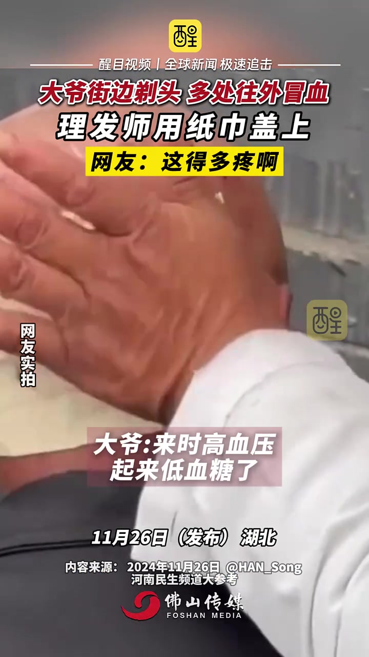 大爷街边剃头多处往外冒血，理发师用纸巾盖上！
