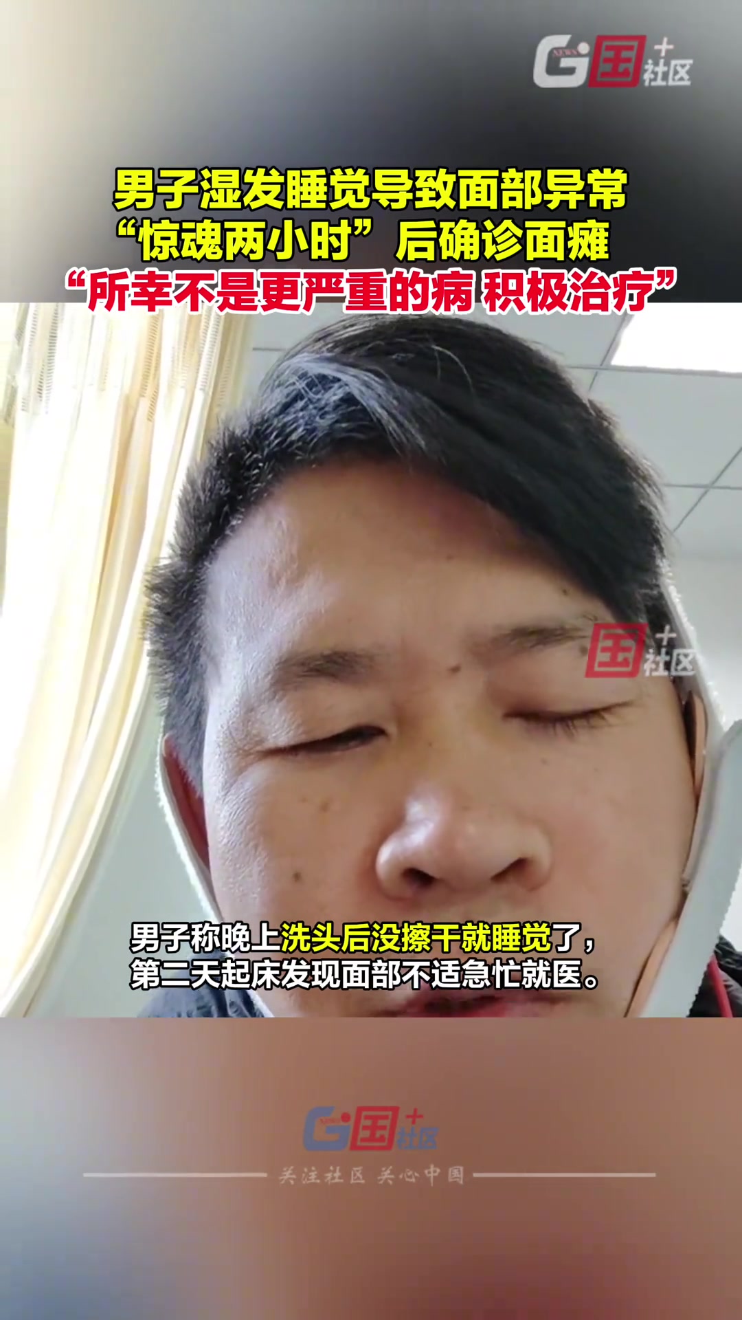 陕西渭南男子称湿发睡觉导致面瘫，所幸并无大碍