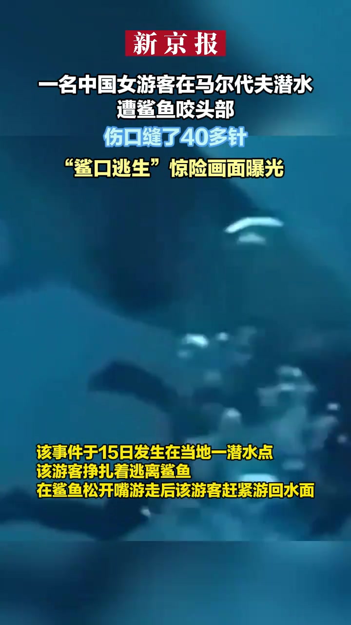 一名中国女游客在马尔代夫潜水遭鲨鱼咬头部伤口缝了40多针