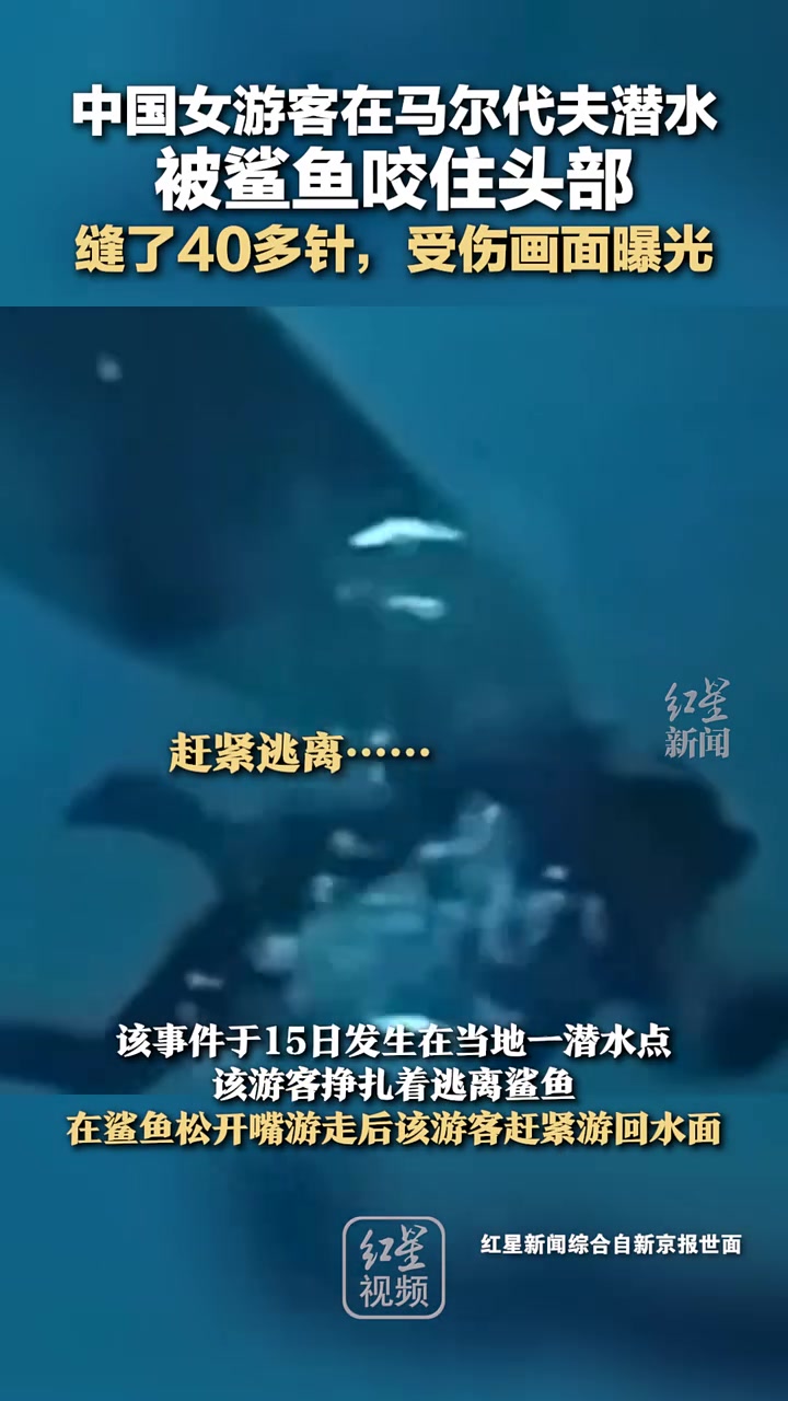女游客在马尔代夫潜水被鲨鱼咬住头部，缝了40多针！