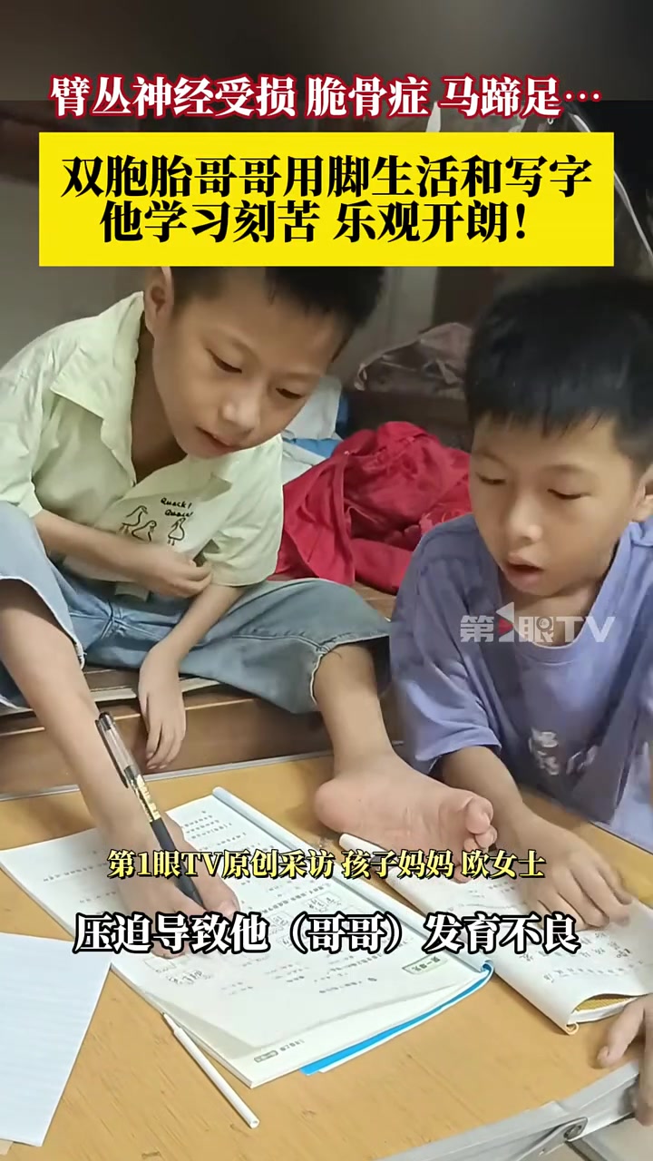 双胞胎哥哥患病后用脚生活和写字妈妈：他是一个坚强乐观的孩子