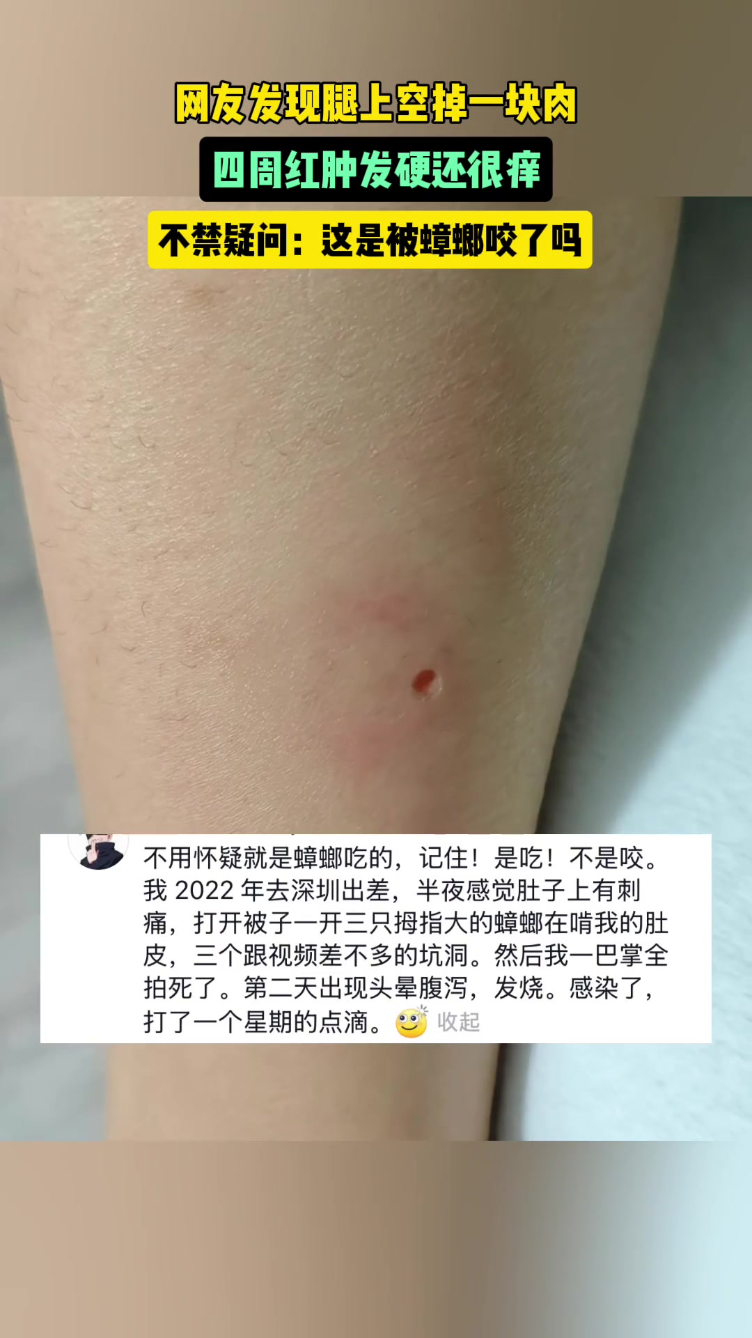什么！蟑螂会咬人活了这么久才知道！