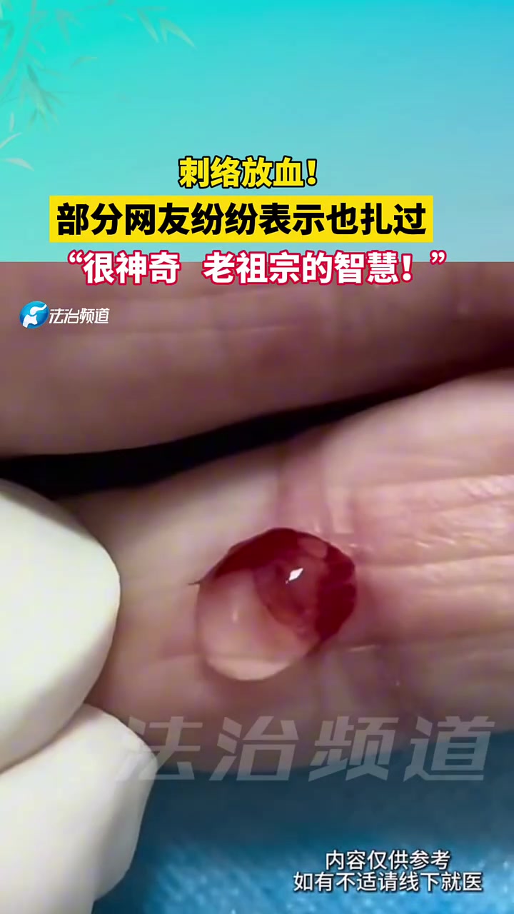 刺络放血！部分网友纷纷表示也扎过，“很神奇老祖宗的智慧！