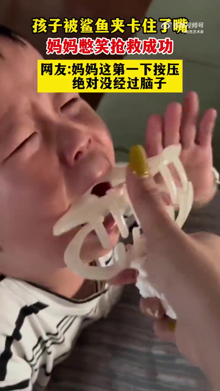 孩子嘴被鲨鱼夹卡住，妈妈憋笑救回，网友称第一下按压太急
