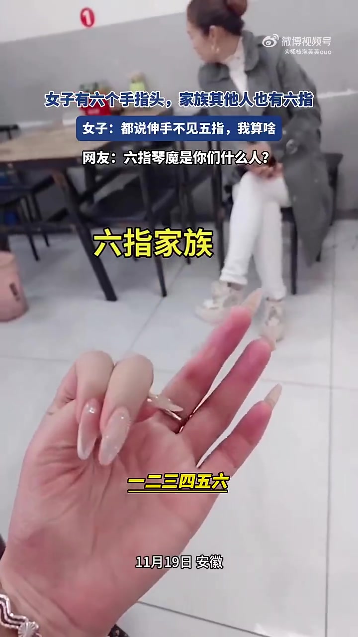 女子及其家族有人六指