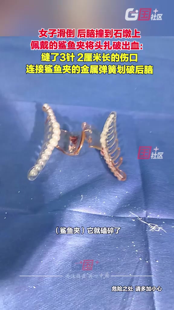 一女子不慎滑倒后脑撞到石墩佩戴的鲨鱼夹将头扎破出血