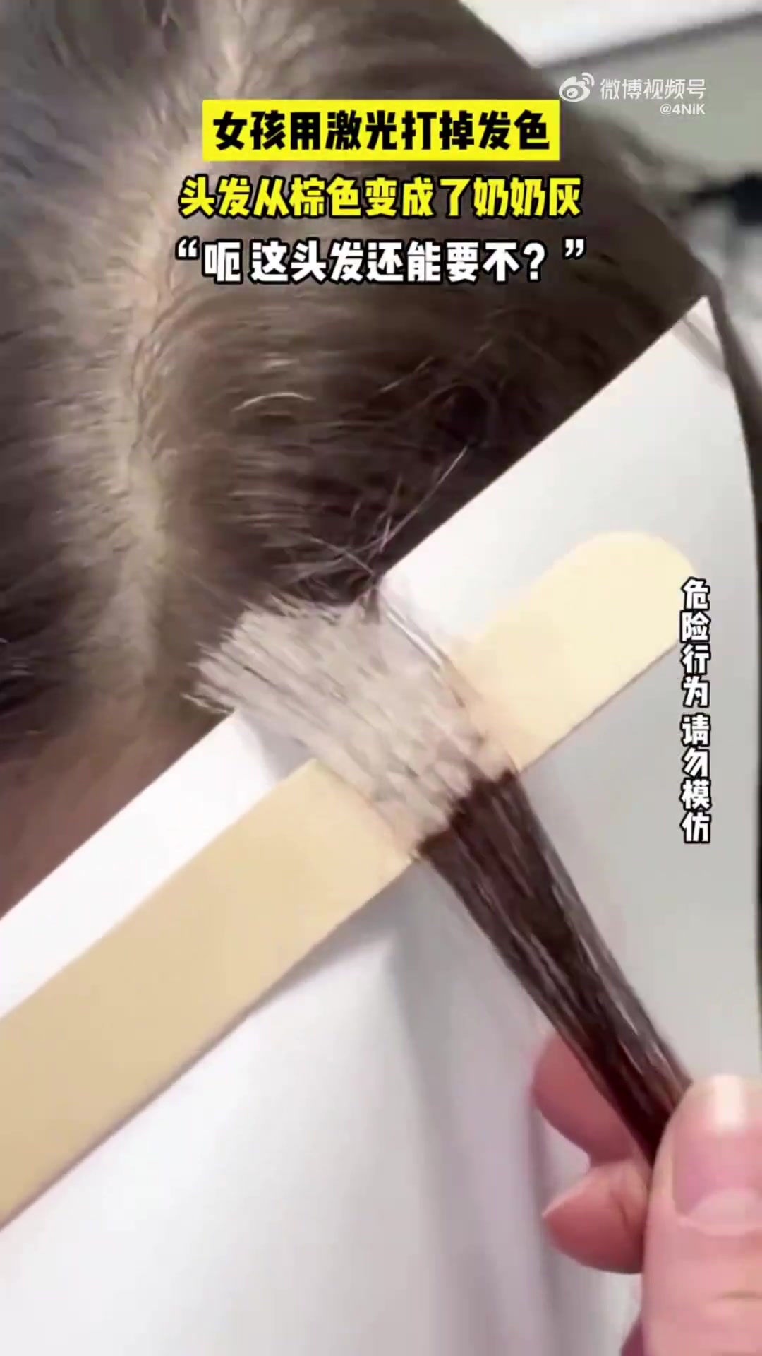 见过激光漂白头发，这头发还能要网友：黑发有酪氨酸酶产黑色素
