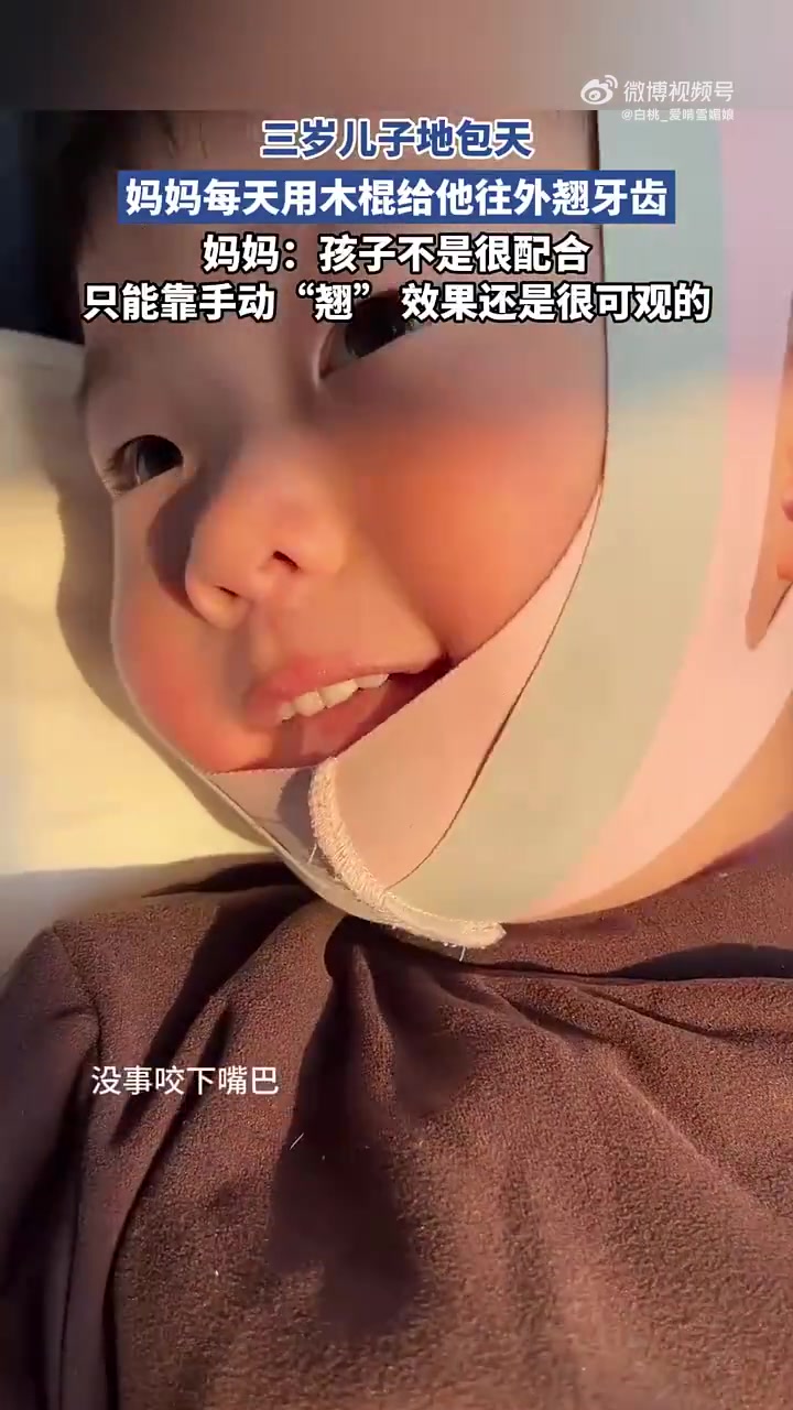 还是去牙科吧！三岁儿子地包天，妈妈每天用木棍给他翘牙齿！