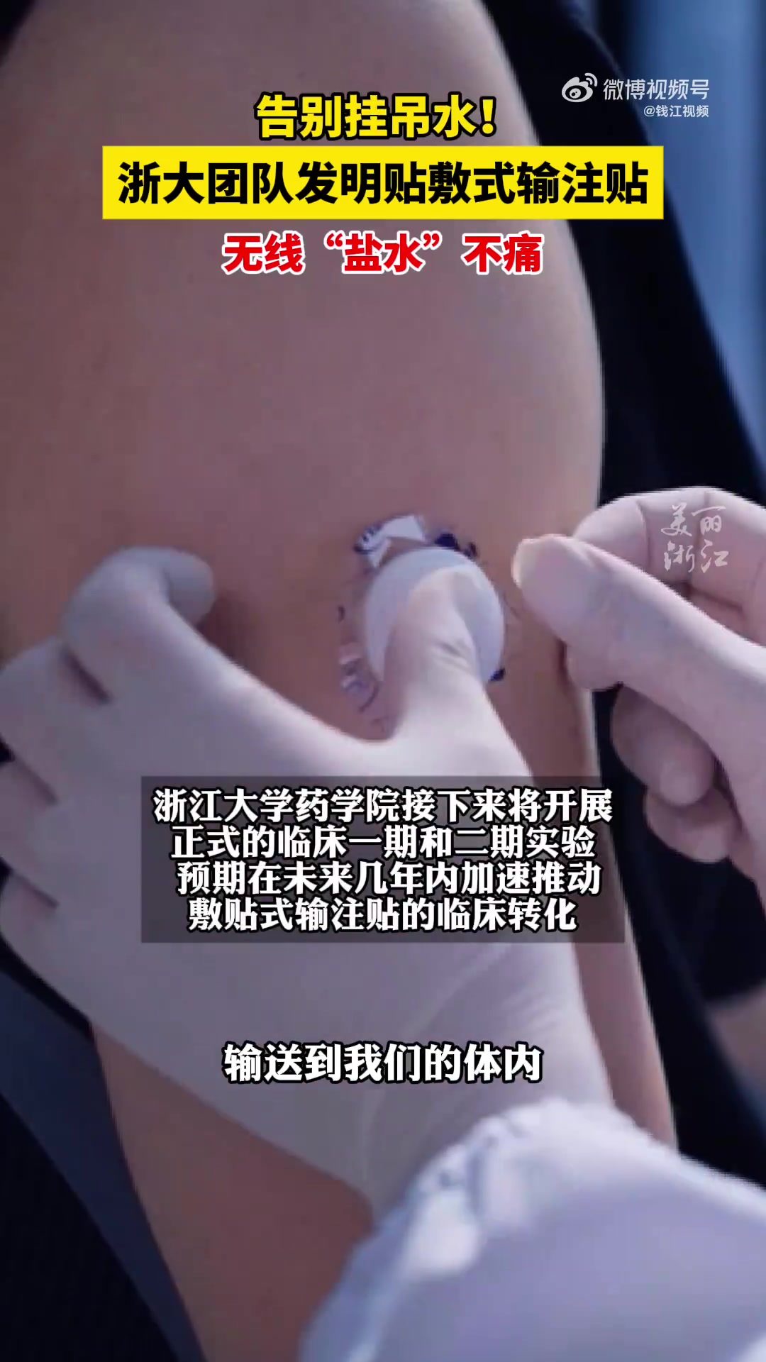 有望实现无线+无痛！挂盐水不用针扎只需贴一张贴纸