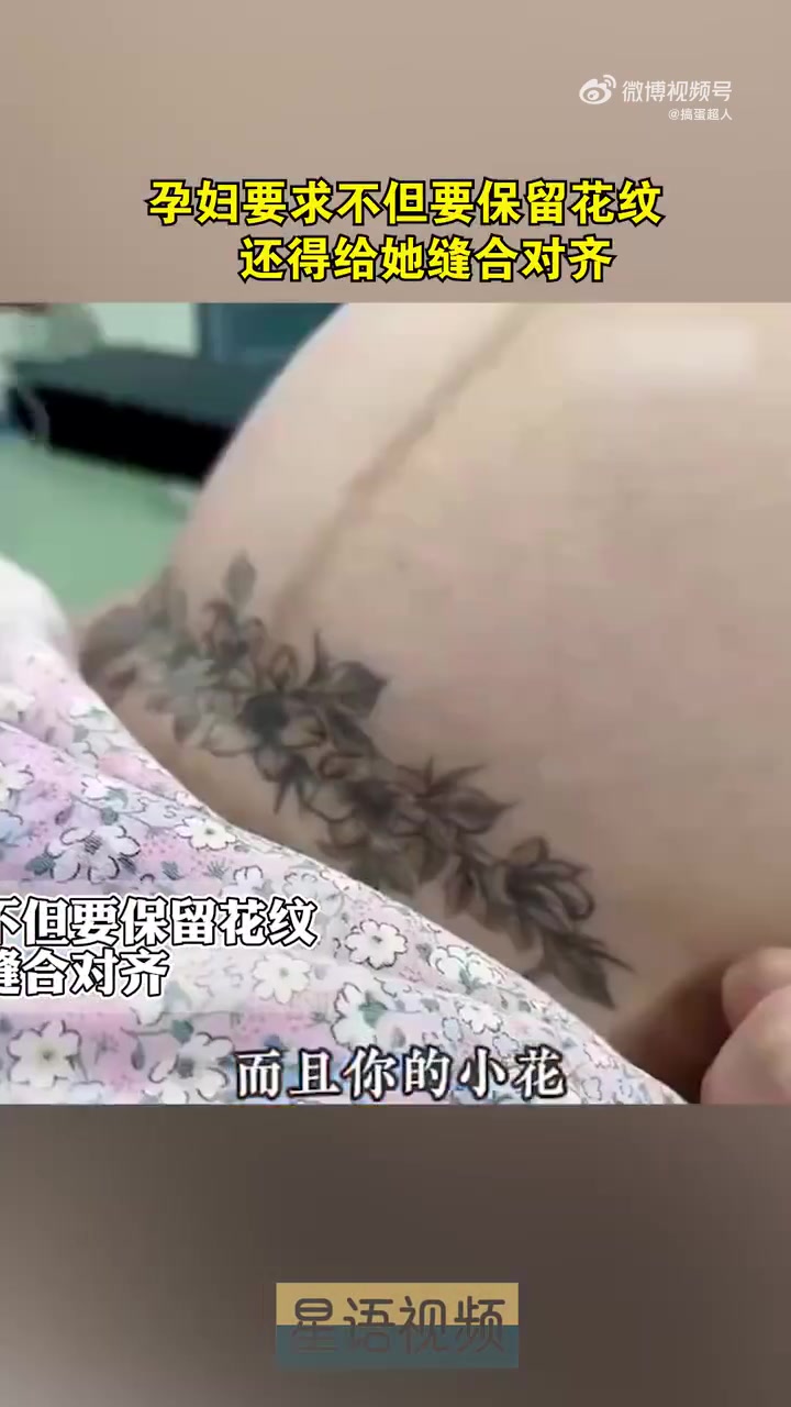 孕妇要求不但要保留花纹，还得给她缝合对齐！