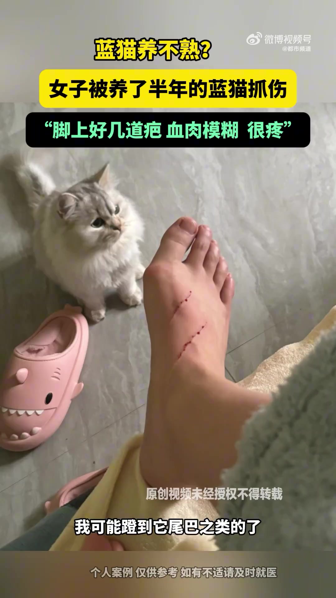 女生被养半年的猫抓伤血肉模糊