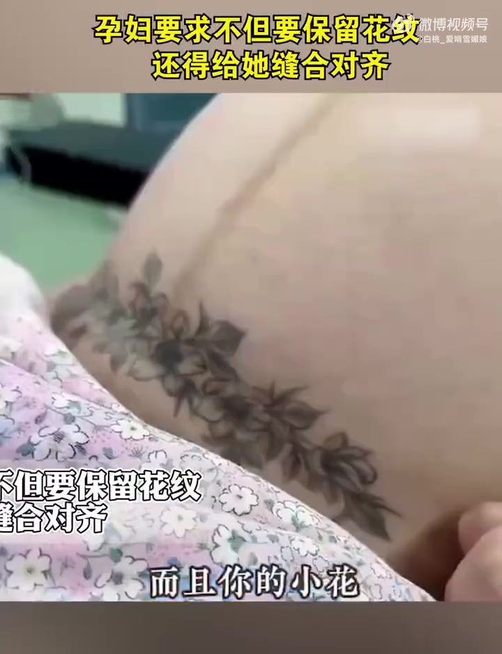 孕妇要求保留花纹且缝合对齐