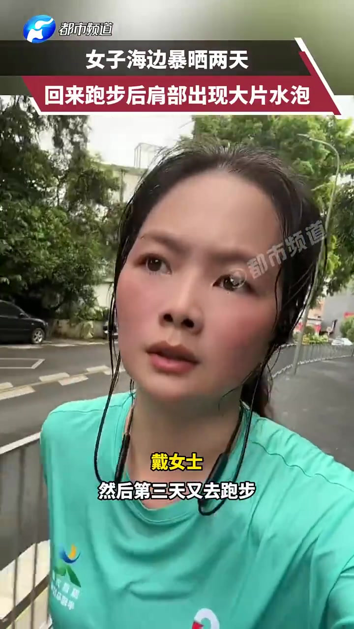 女子海边暴晒两天，回来跑步后肩部出现大片水泡