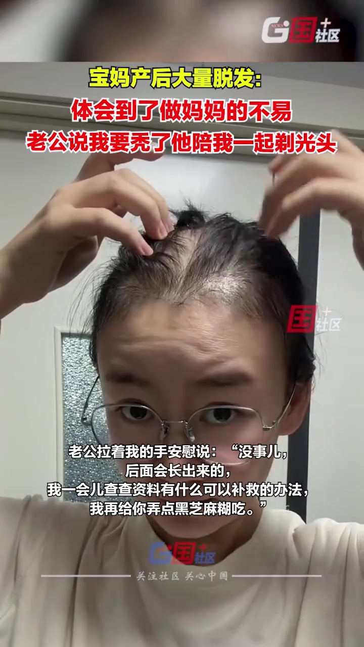 宝妈产后大量脱发，老公安慰真秃了就一起剃光头