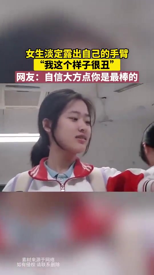 女生淡定露出自己的手臂，“我这个样子很丑”