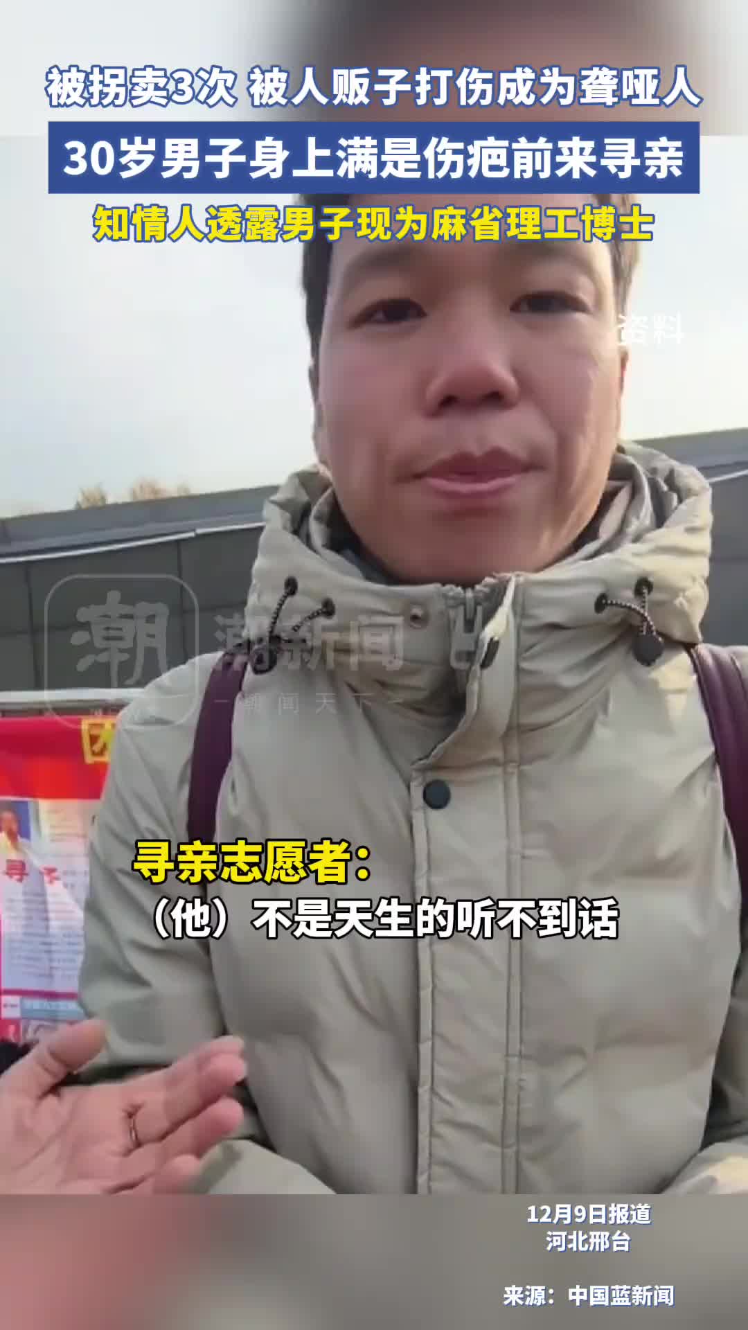 必须严惩人贩子，后天造成的聋哑能治好吗多好多励志的人！