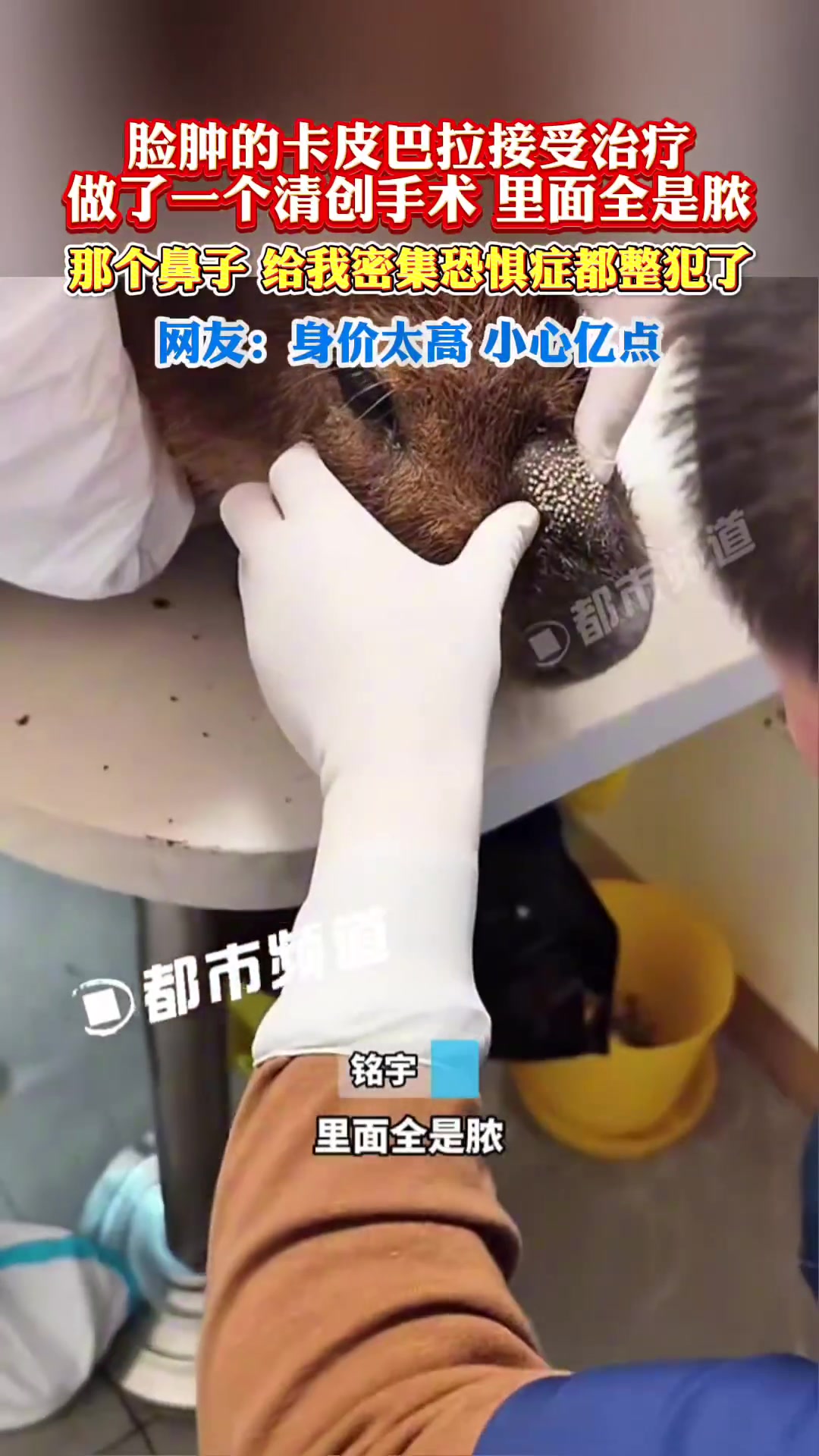 脸肿的卡皮巴拉接受治疗，做了一个清创手术，里面全是脓