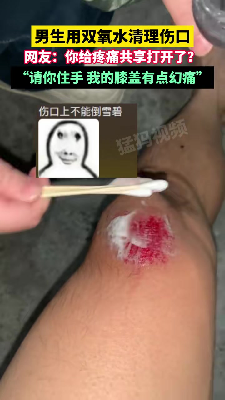 男生用双氧水清理伤口，网友：你给疼痛共享打开了！
