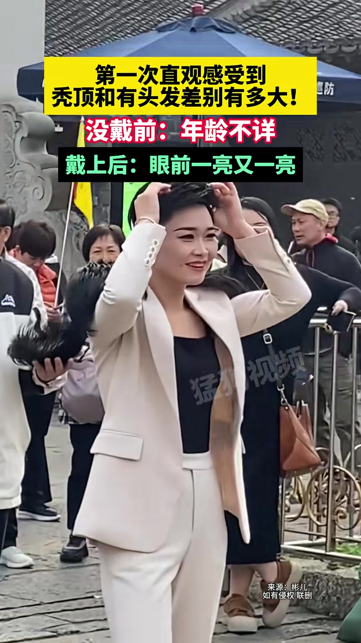 第一次直观感受到，秃顶和有头发差别有多大！