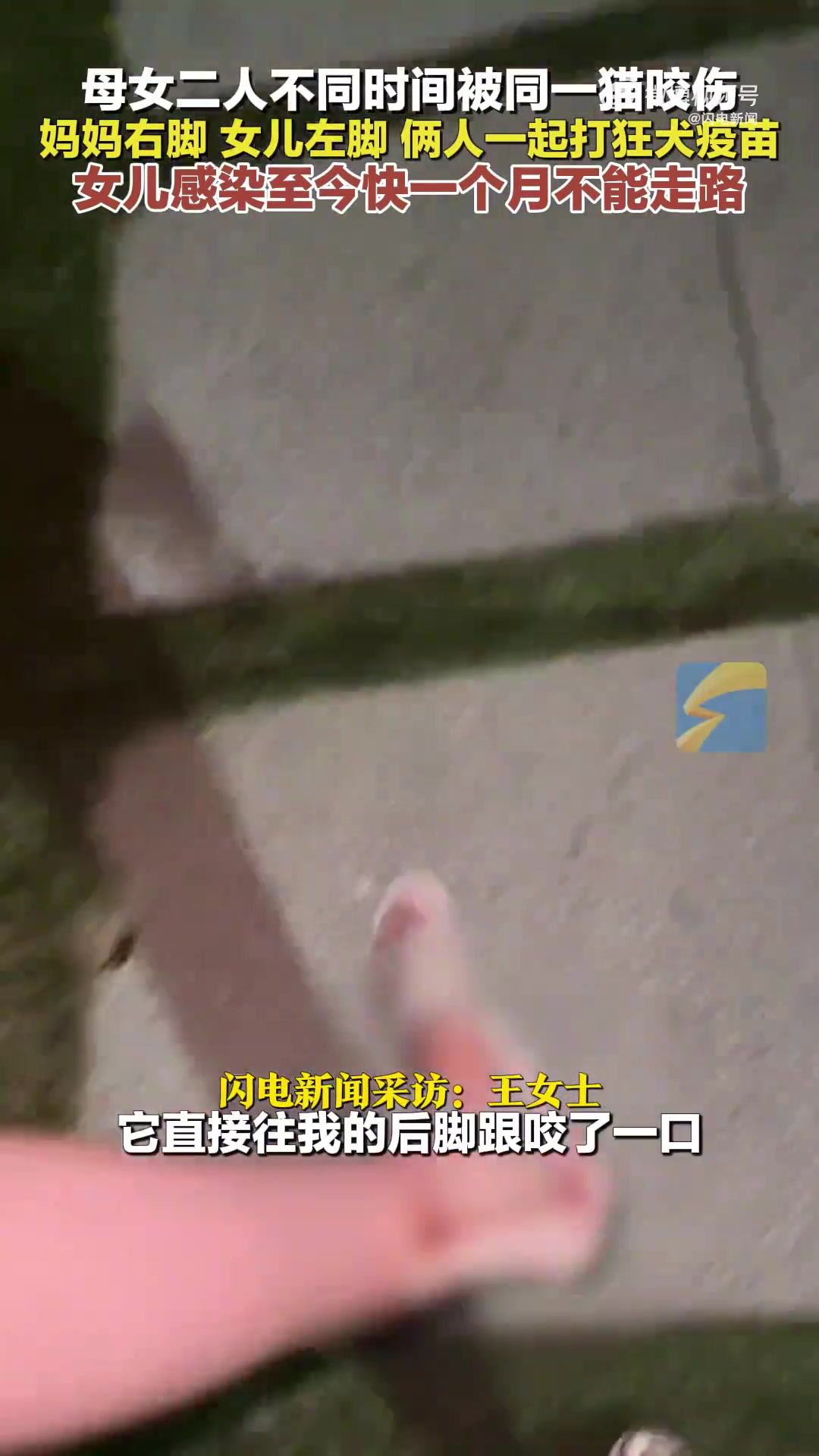 女子下楼时被楼下流浪猫咬，女儿也被咬！