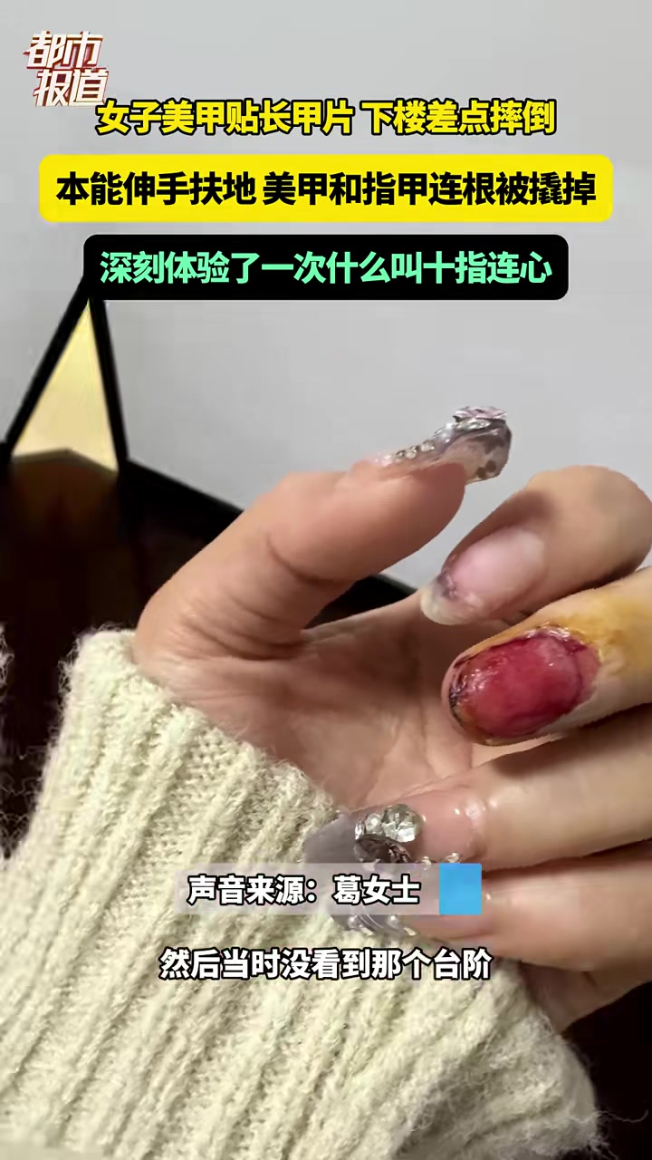 女子下楼差点摔倒，本能伸手扶地美甲和指甲连根被撬掉