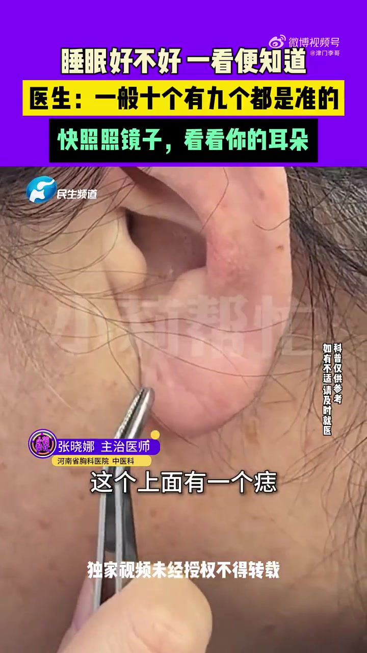 睡眠好不好一看便知道！医生：一般十个有九个都是准的