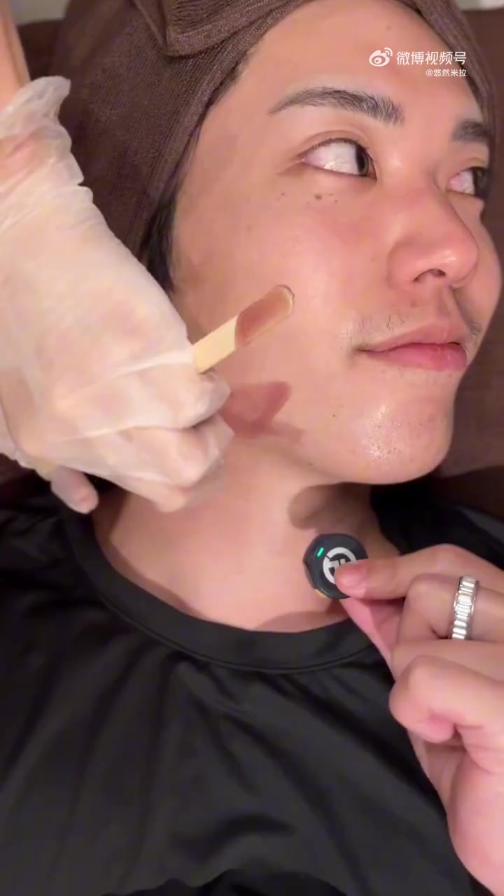 臭美的日本男生用脱毛蜡清除脸上毛发