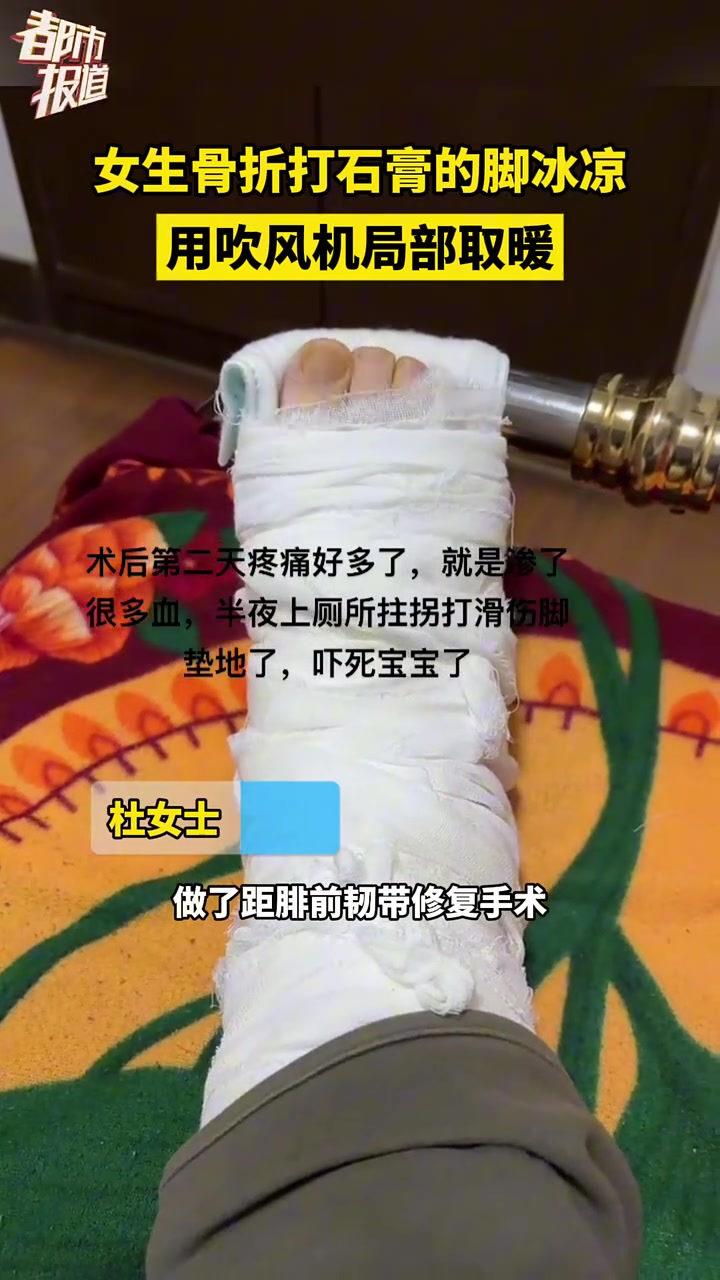 女生骨折打石膏的脚冰凉，用吹风机局部取暖