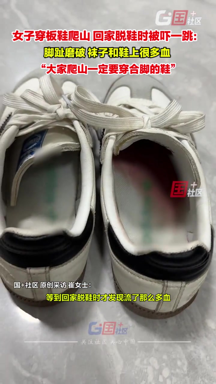 女子穿板鞋爬山，回家脱鞋时被吓一跳：袜子和鞋上很多血
