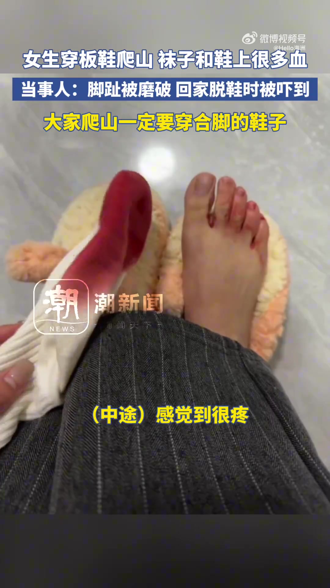 女生穿板鞋爬山袜子和鞋上很多血