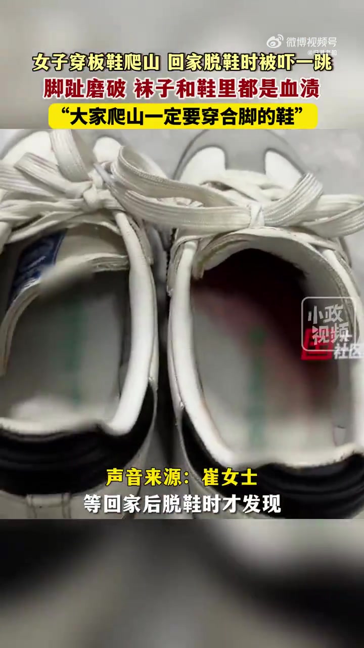 血淋淋的也太可怕了吧，这忍耐力真够可以的！