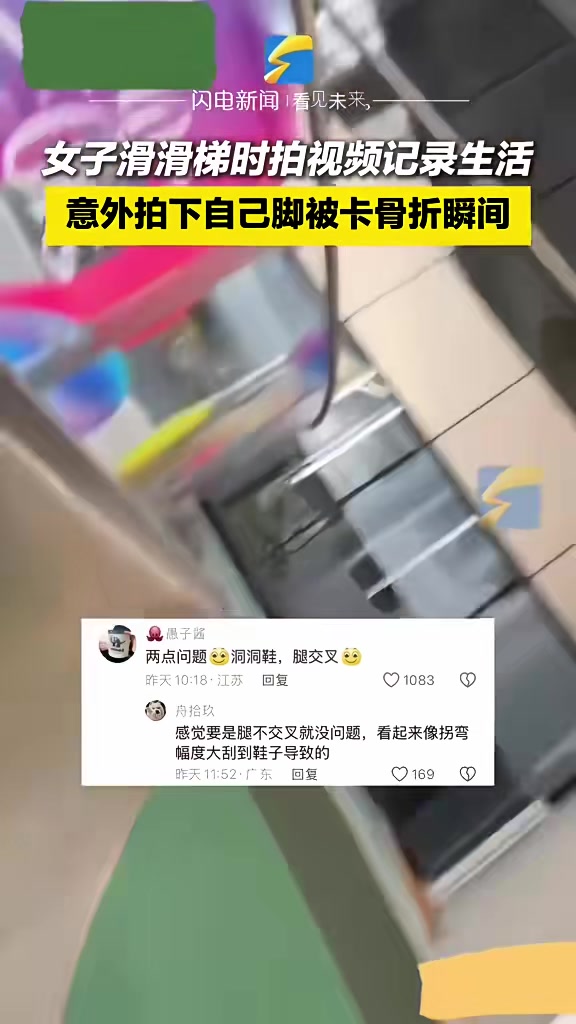 医生：咋整这样的，患者：请看vcr