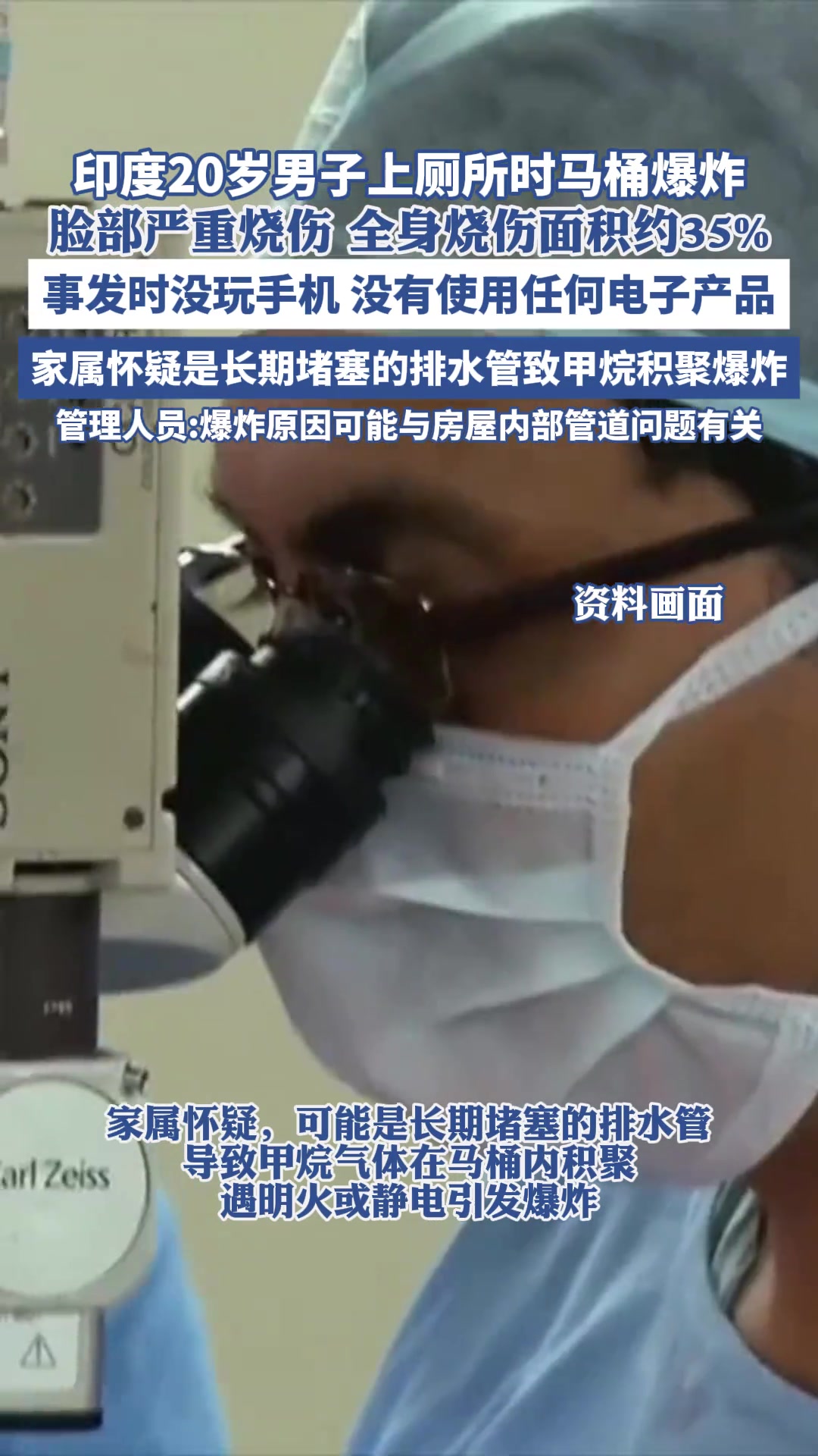 印度20岁男子上厕所时马桶爆炸，致其脸部严重烧伤