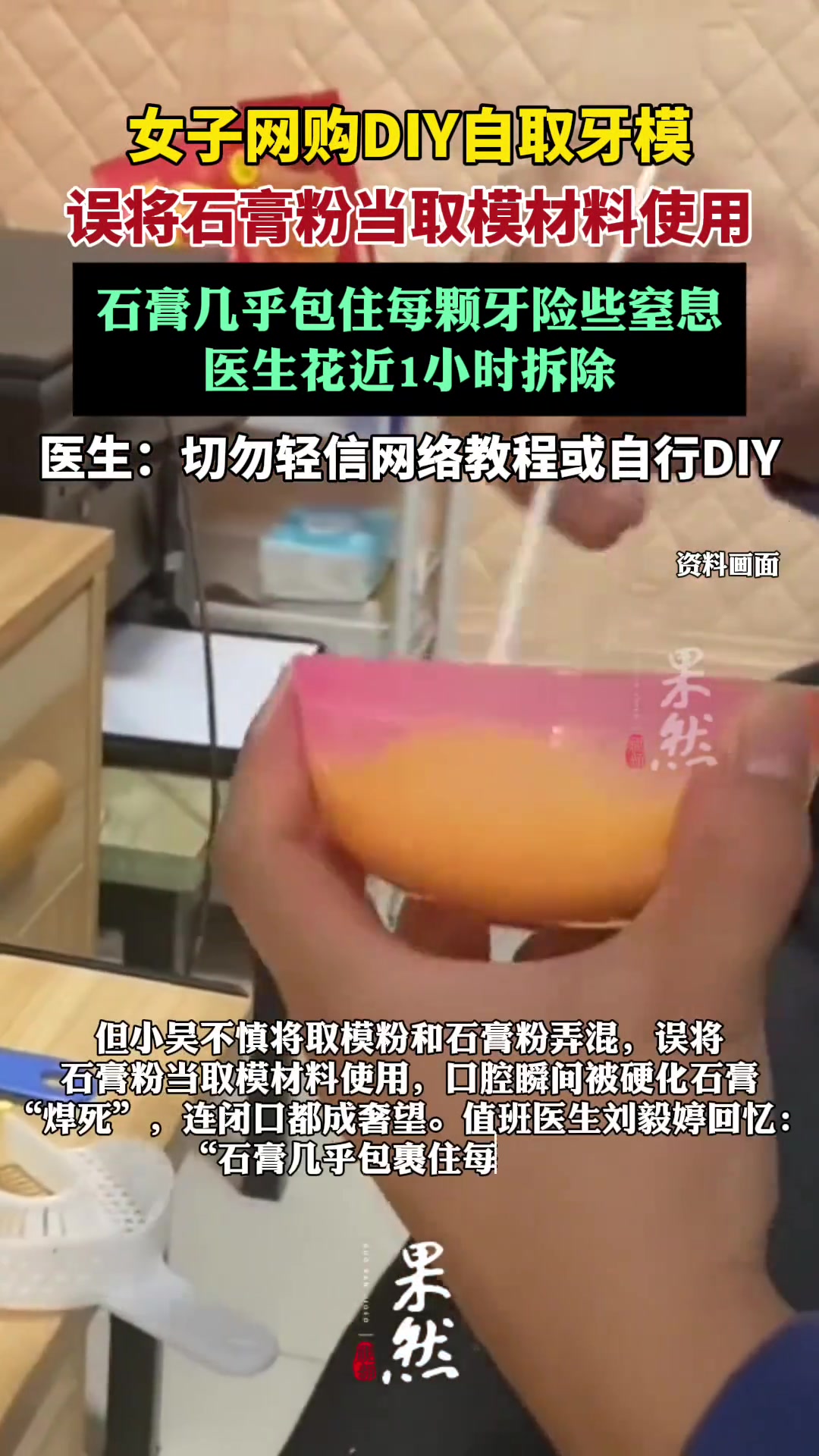 女子自取牙模拿错材料嘴被石膏焊死