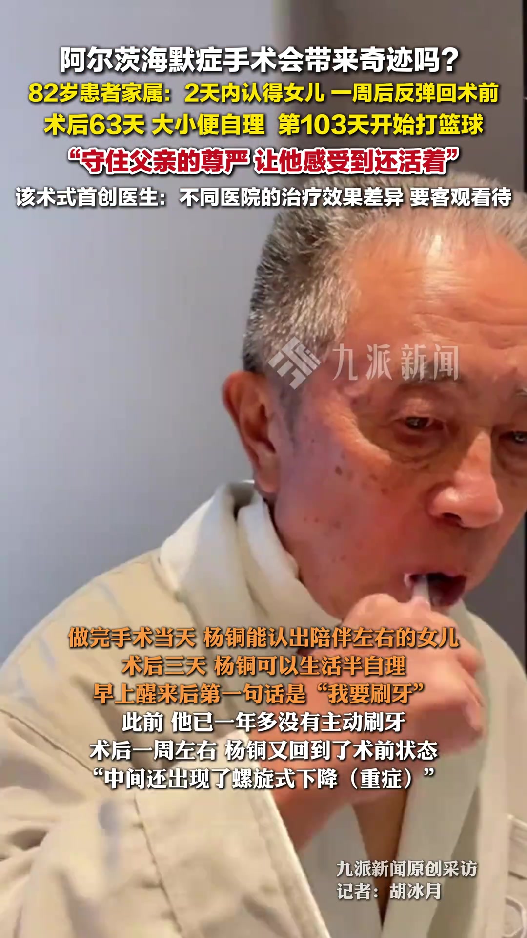 阿尔茨海默症手术会带来奇迹吗