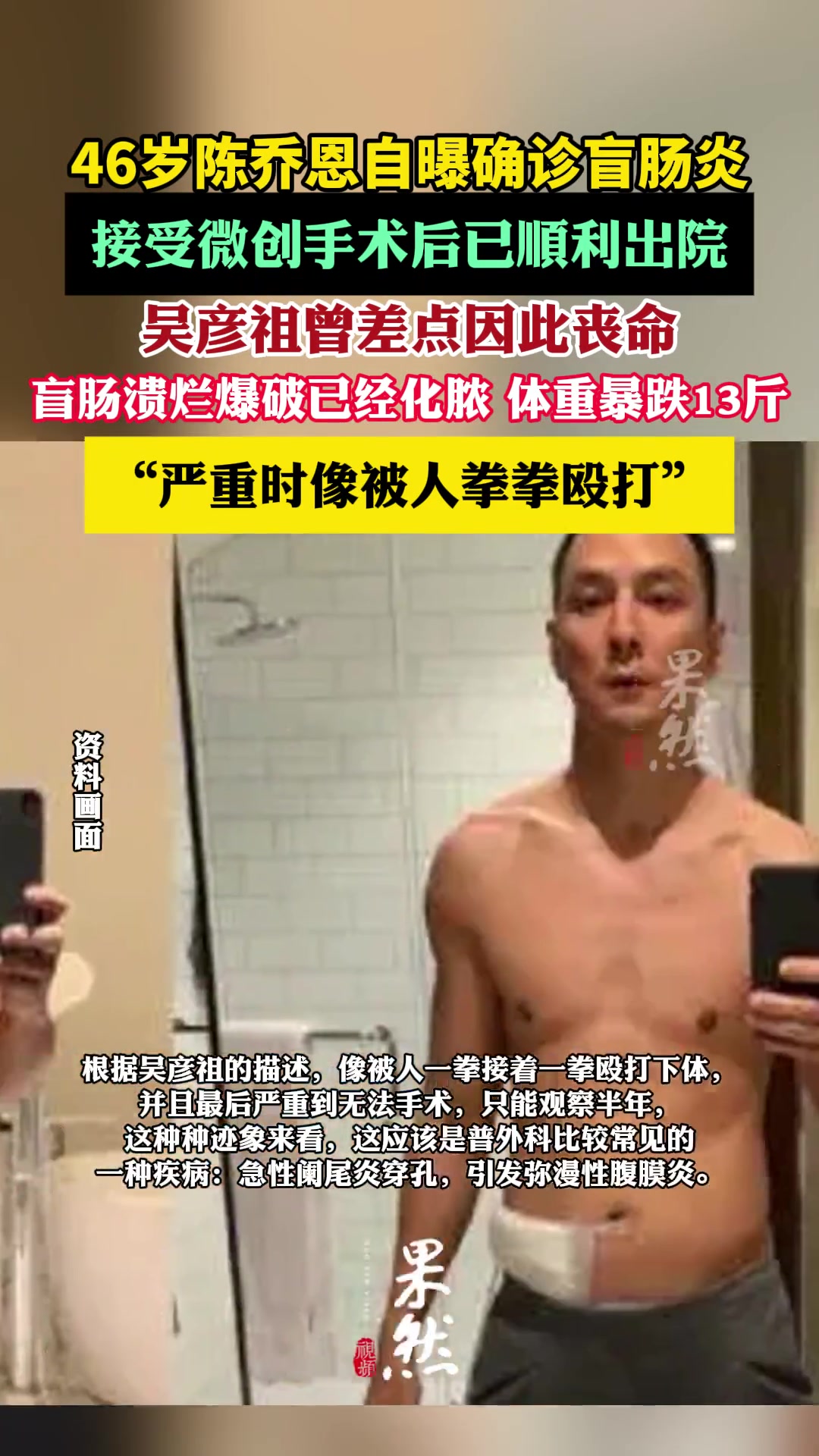 46岁陈乔恩自曝确诊盲肠炎