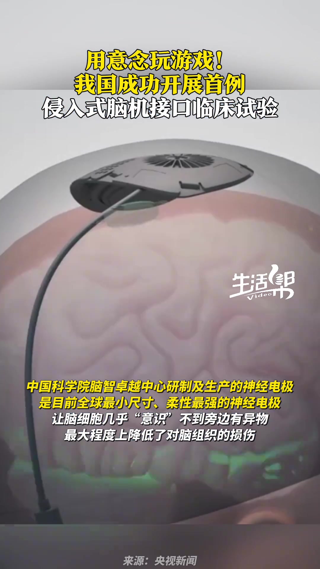 我国成功开展首例侵入式脑机接口临床试验，实现用意念玩游戏