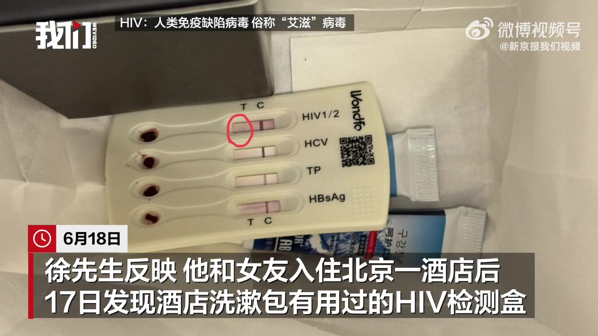 酒店洗漱包内发现用过的HIV检测盒