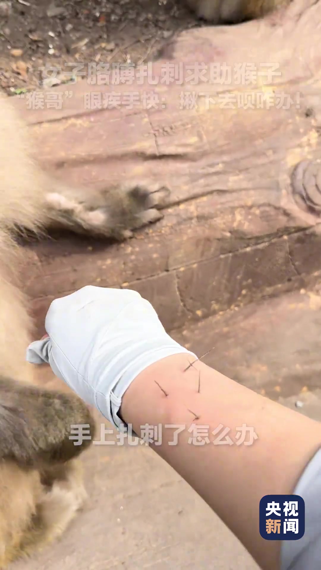 女子胳膊上扎刺找猴子“帮忙”，“猴哥”零帧起手瞬间搞定