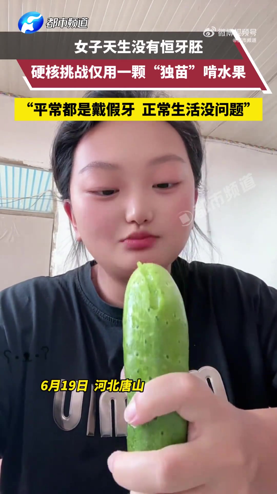 河北女子天生缺恒牙胚！用一颗牙啃水果
