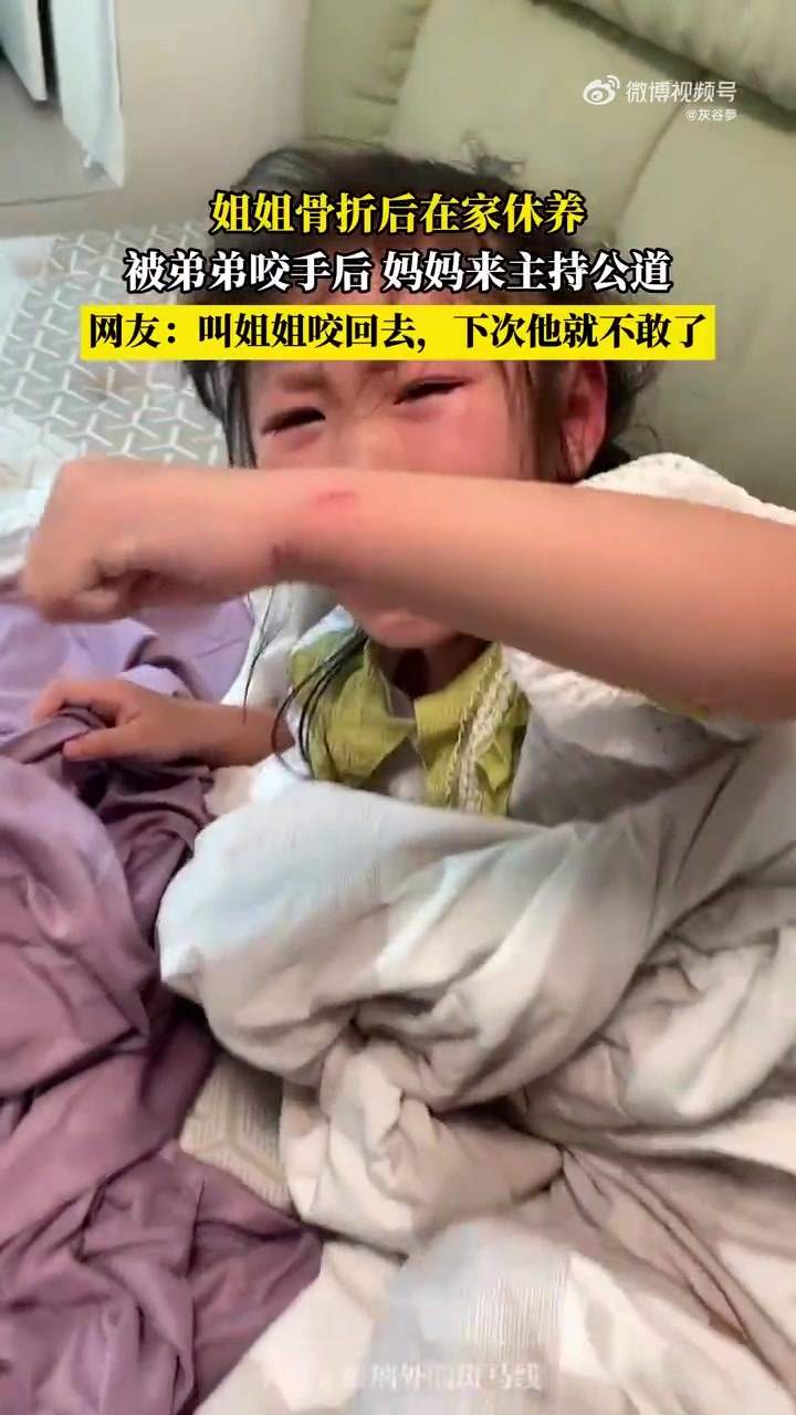 姐姐骨折后在家休养，被弟弟咬手后妈妈来主持公道