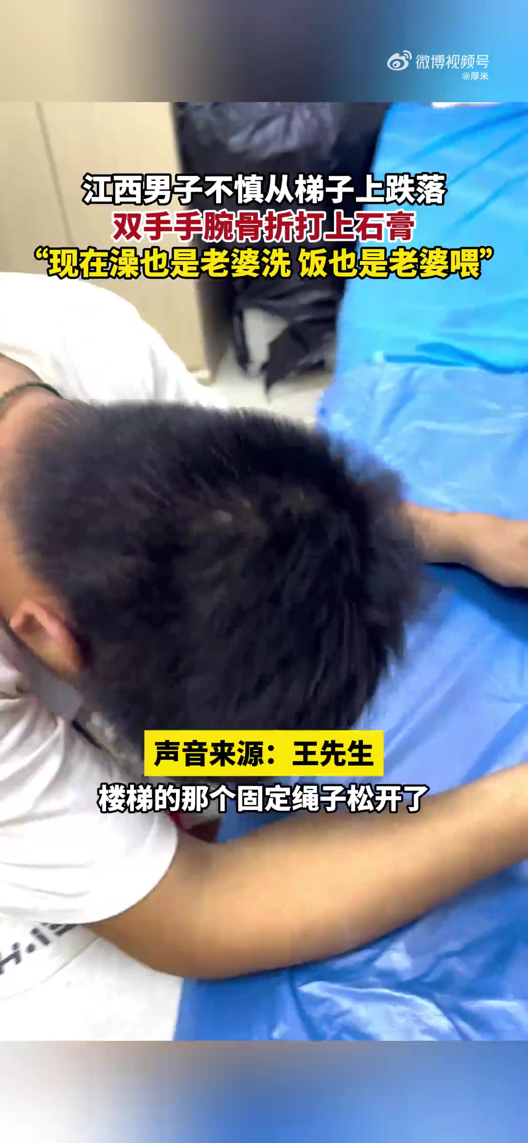 男子不慎从梯子上跌落，双手手腕骨折打上石膏