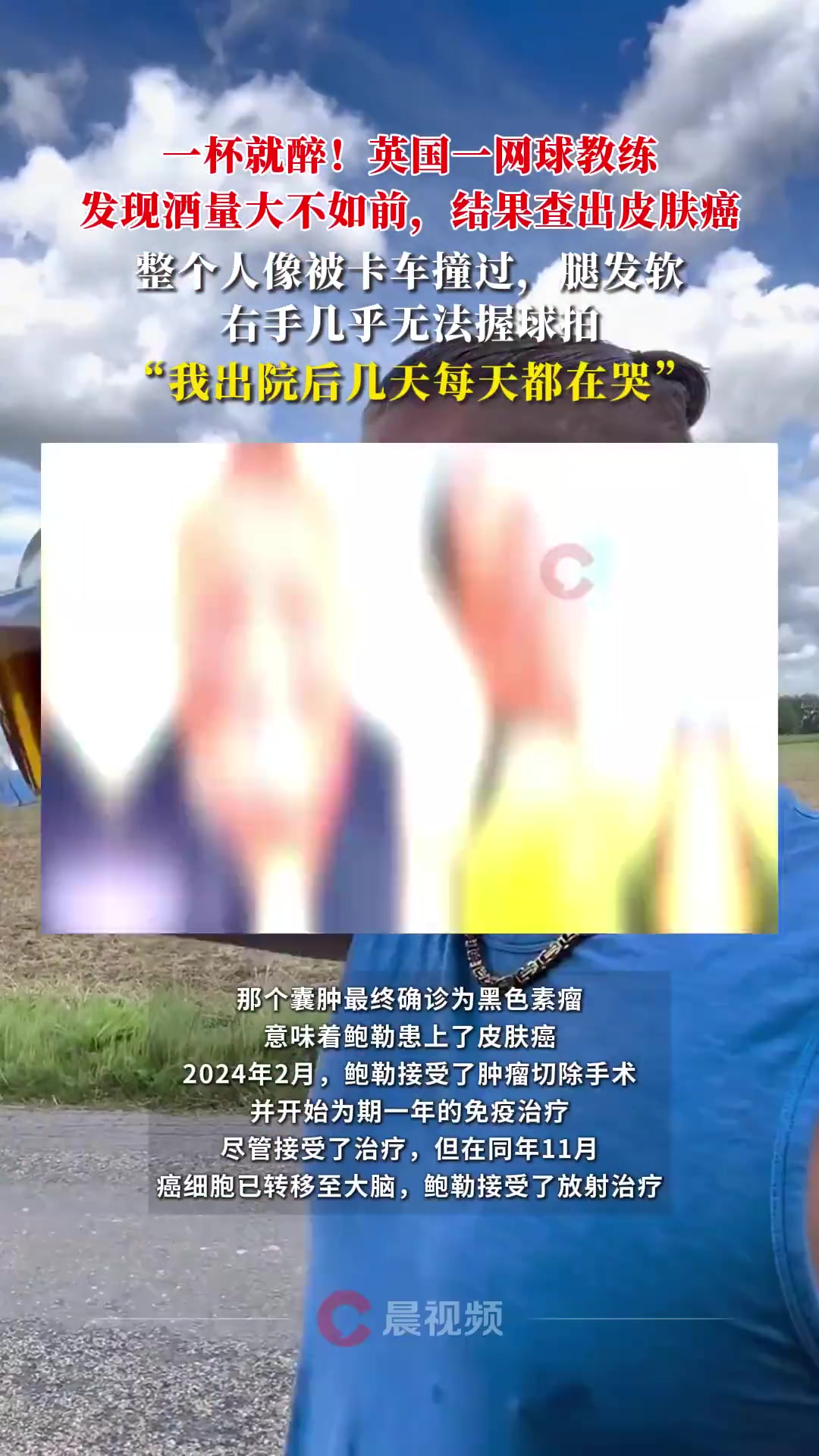男子酒量大不如前结果查出癌症