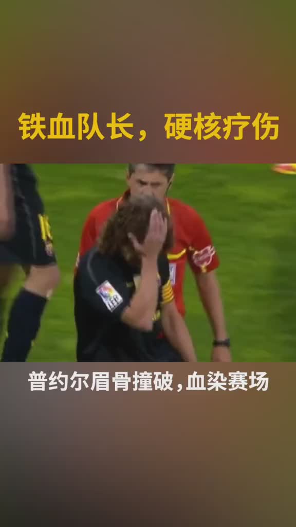 什么是真硬汉?眉骨撞裂后，用订书机缝合迅速返场