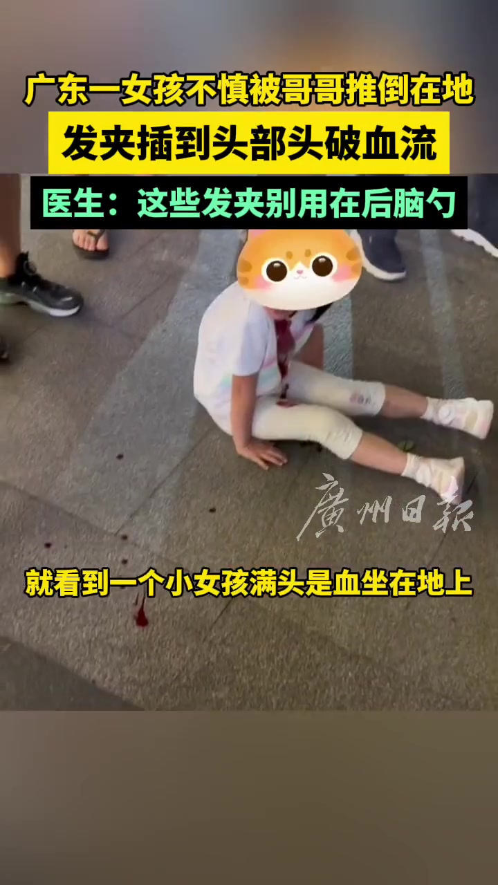 小女孩不慎被哥哥推倒在地 发夹插到头部头破血流