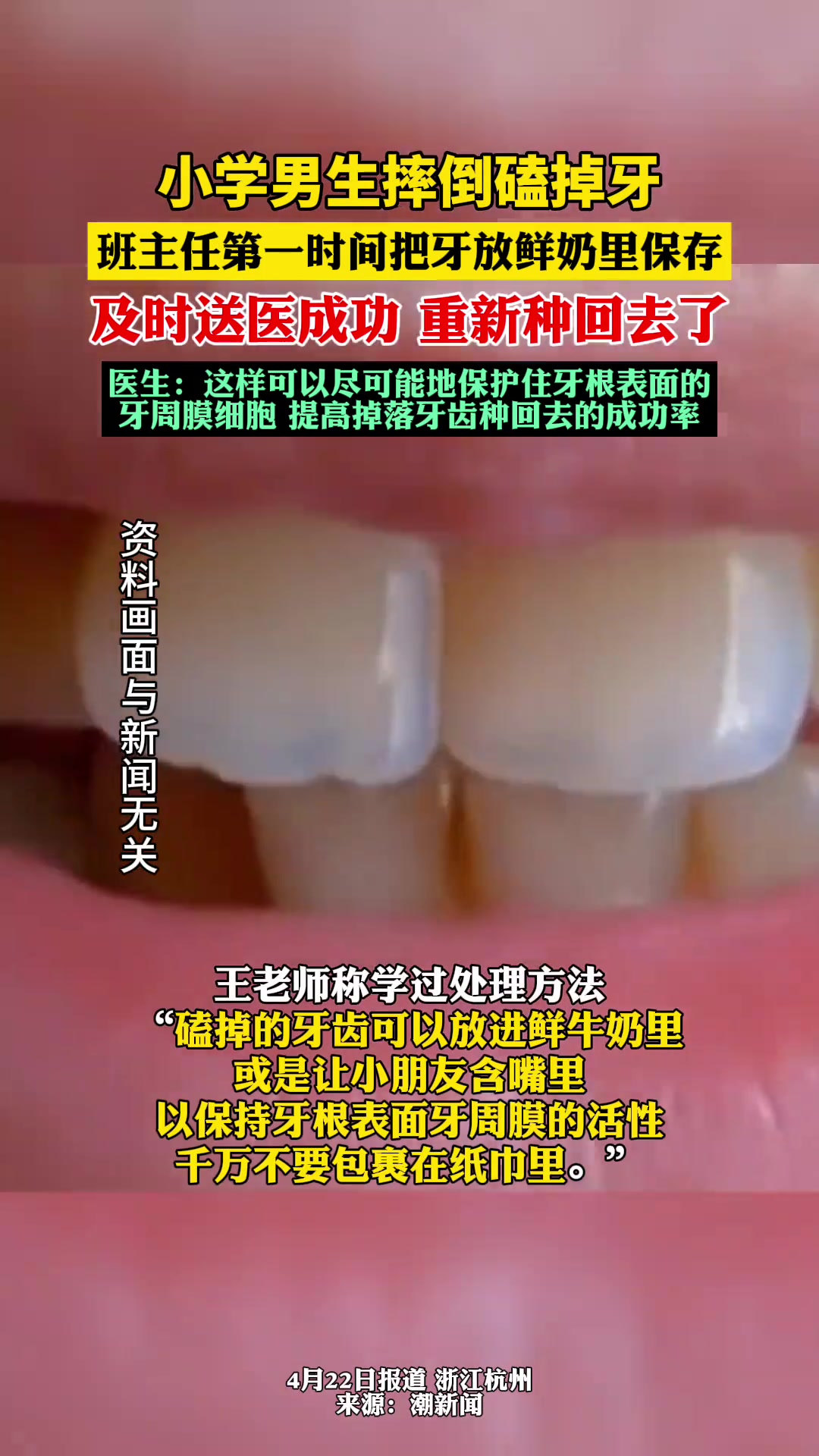 小学男生磕掉牙，老师把牙放鲜奶里保存得以种回去