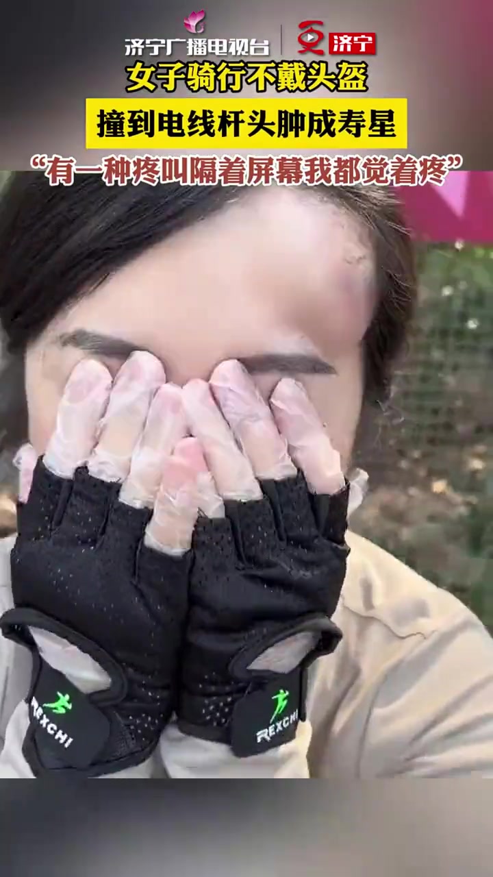 女子不带头盔骑车撞到电杆头肿成寿星