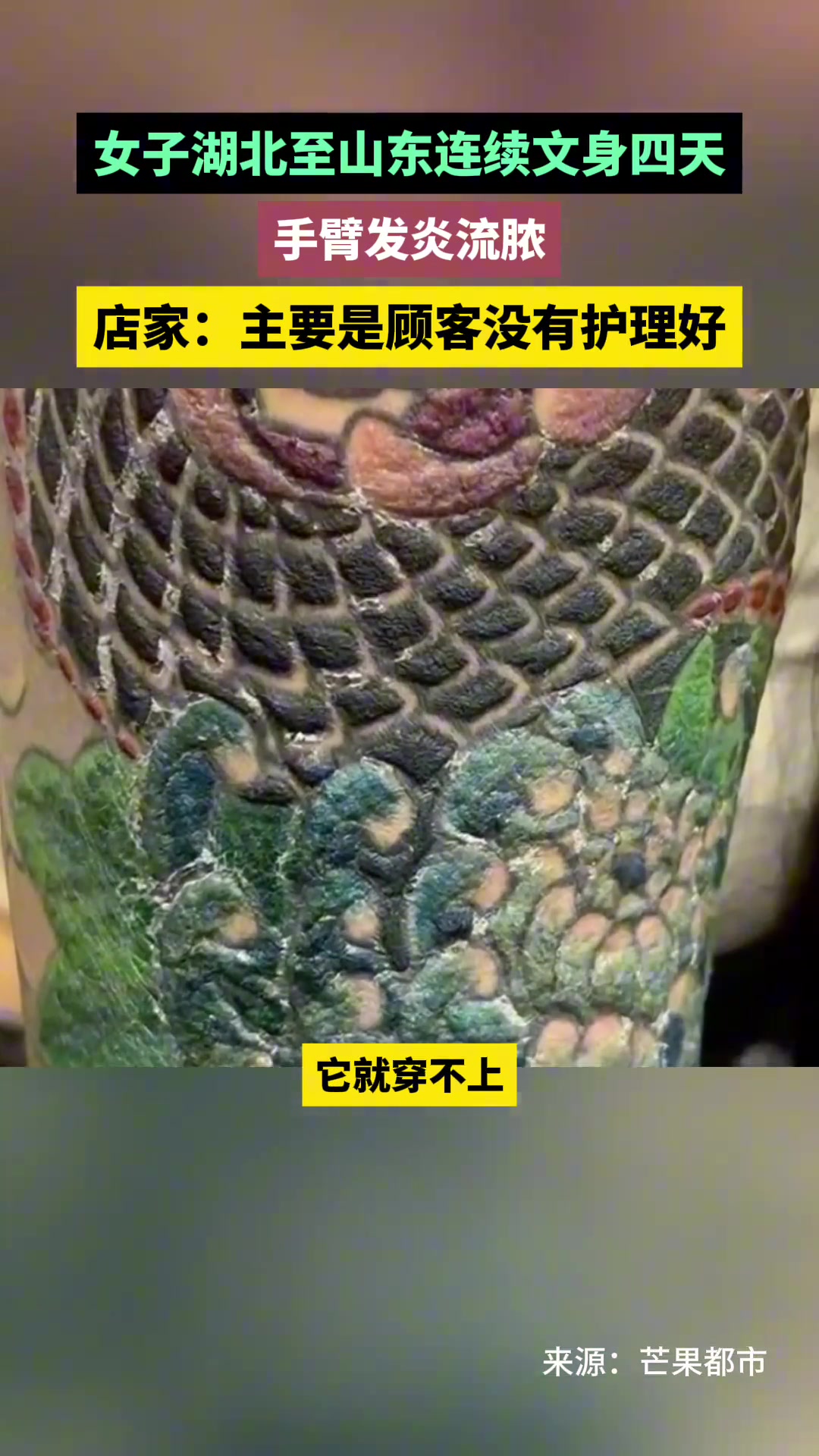 小姐姐纹身花臂连续4天，最终手臂发热发炎！