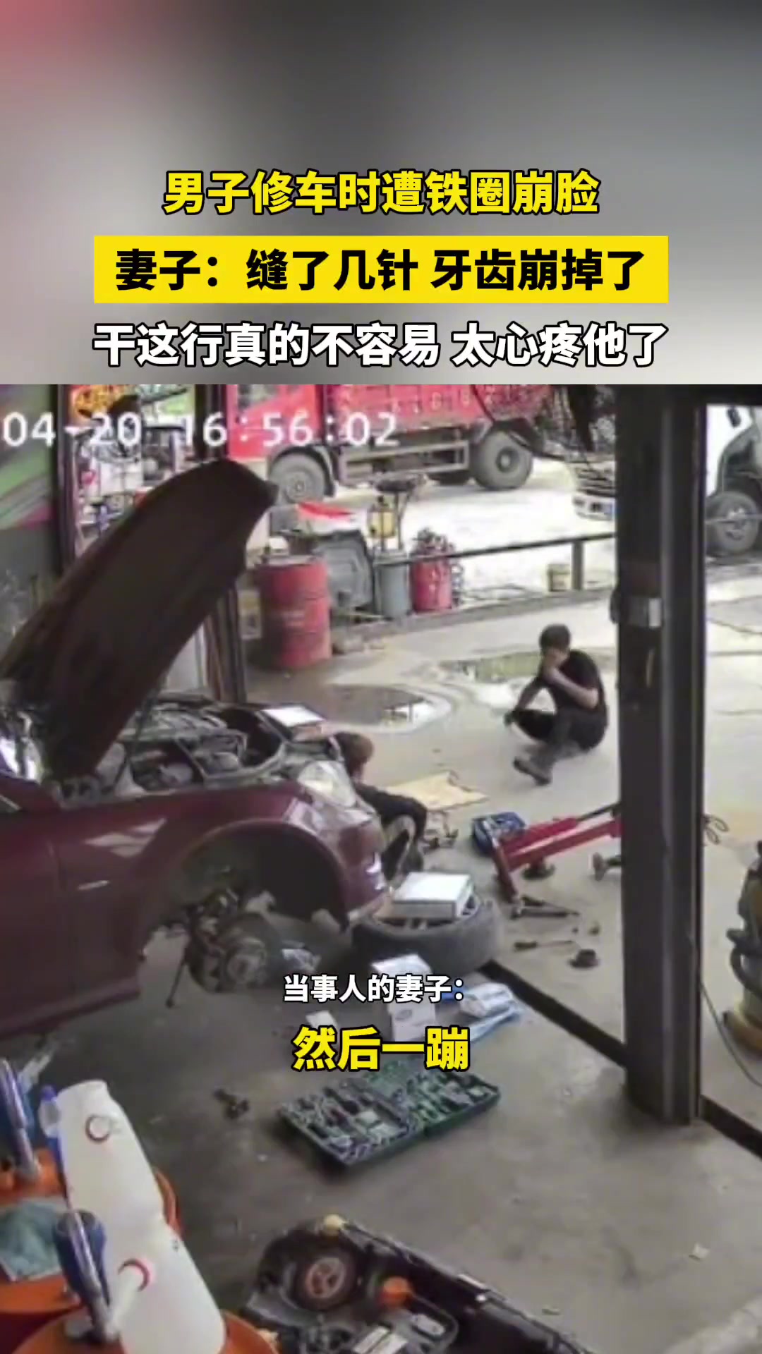 男子修车时遭铁圈崩脸，妻子：缝了几针 牙齿崩掉了