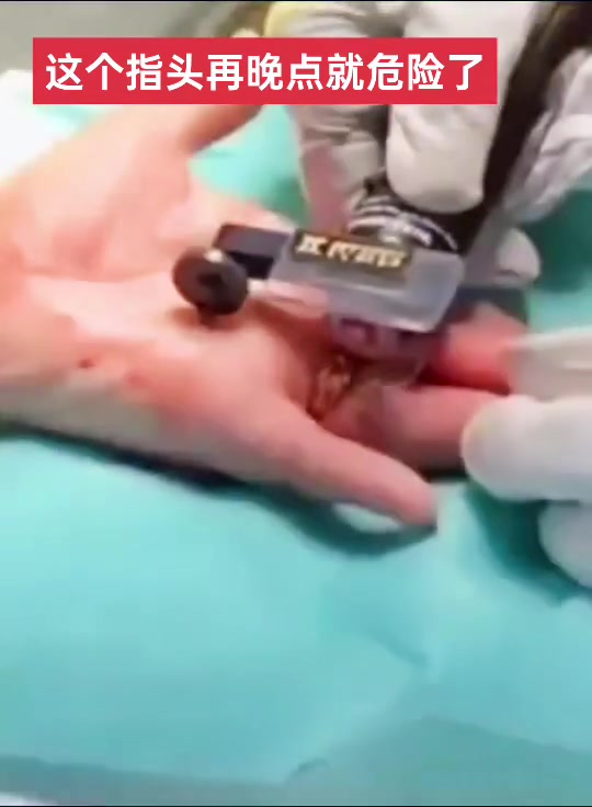 想不通为什么要到这么严重了才处理